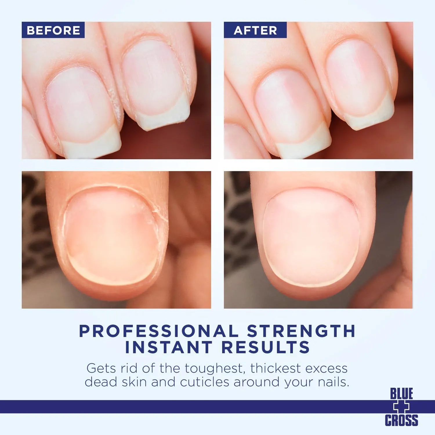 Blue Cross Cuticle Remover Liquid, Cuticle Softener for Nails, Professional Nail Care with Lanolin for Brittle Hang Nails, Hydrating, Moisturizing, Dry Cuticles, Made in USA, 32oz