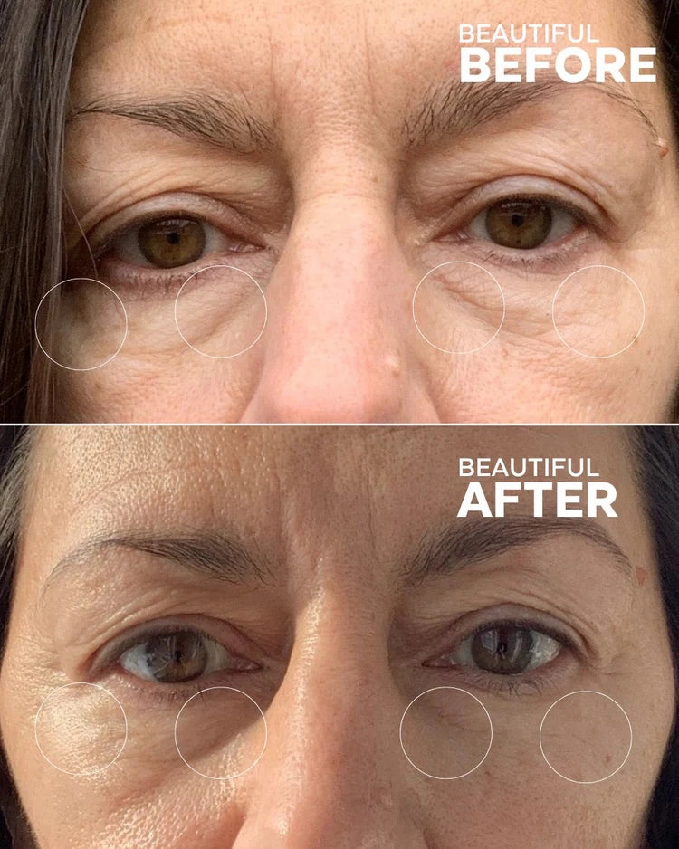 First Light | Vitamin C   Caffeine Eye Cream