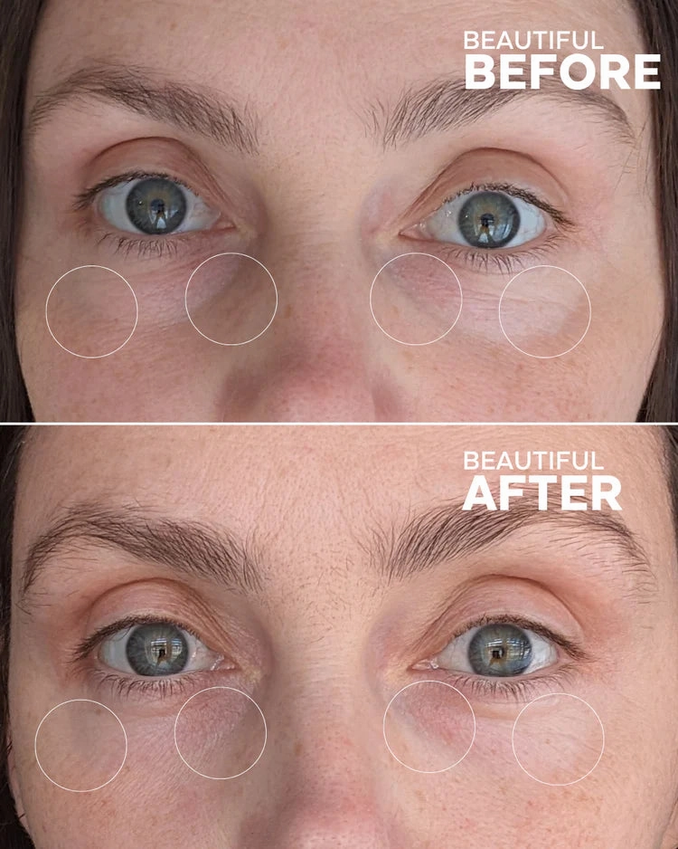 First Light | Vitamin C   Caffeine Eye Cream