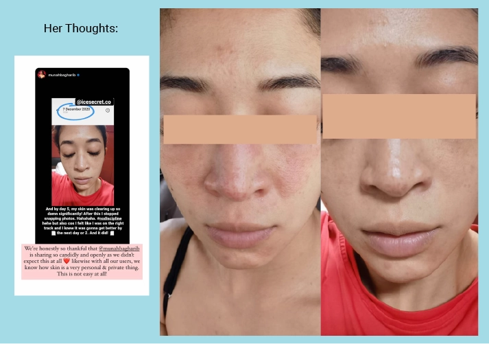 Pore Minimising & Brightening Serum Kit