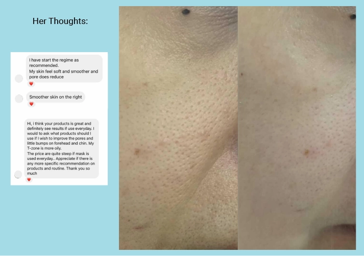 Pore Minimising & Brightening Serum Kit