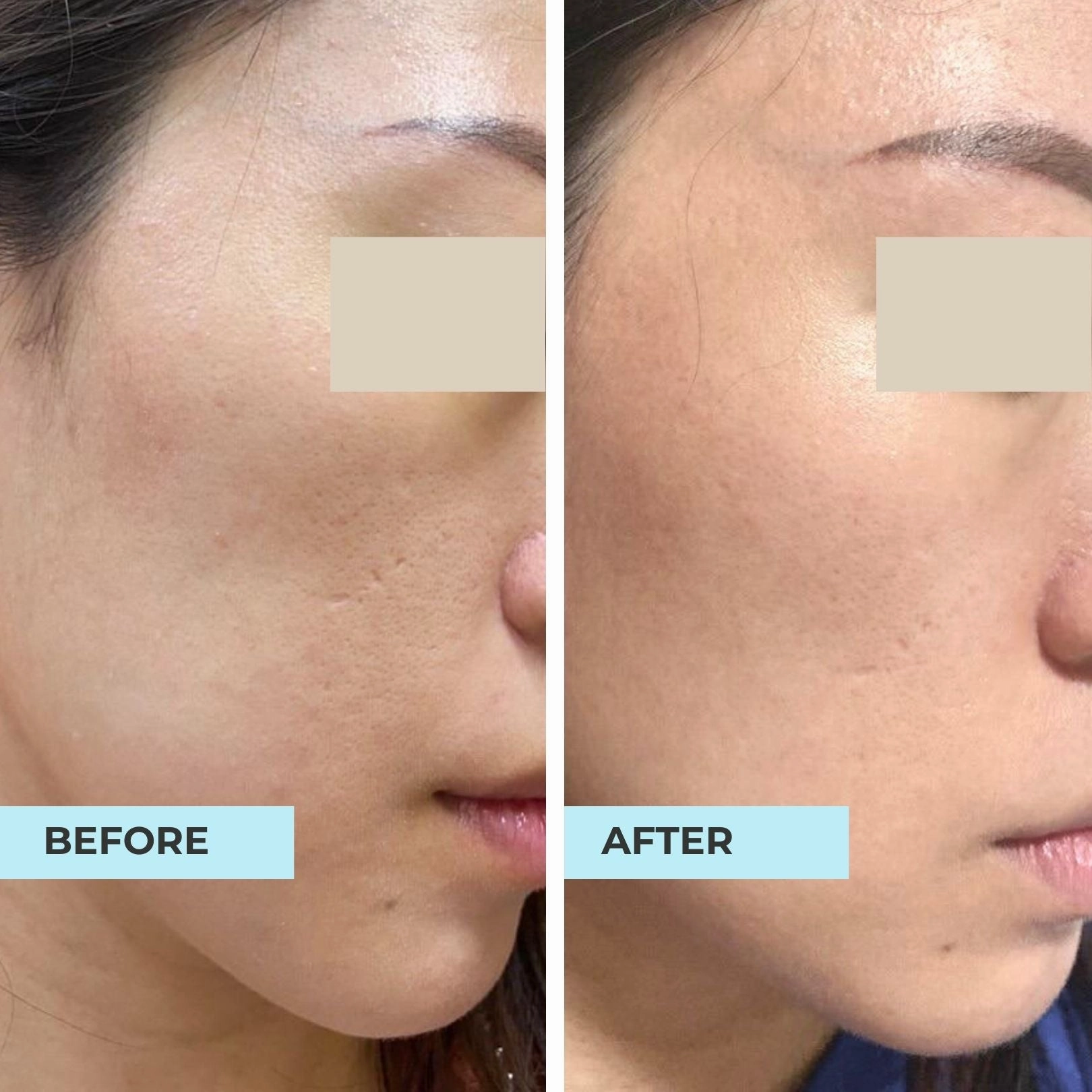 Pore Minimising & Brightening Serum Kit
