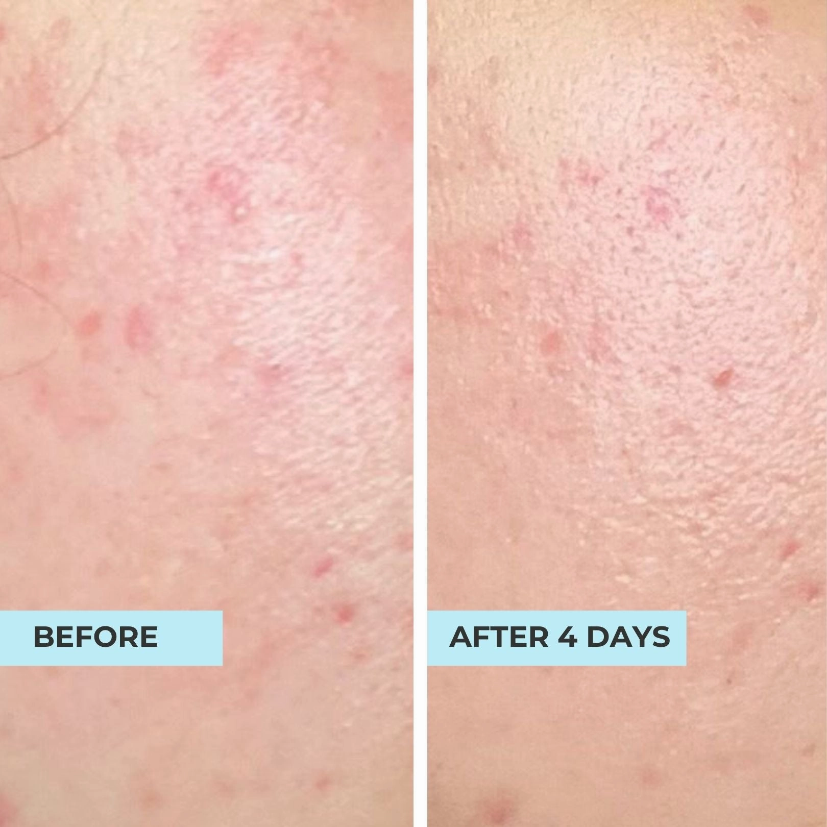 Pore Minimising & Brightening Serum Kit