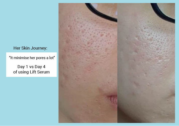 Pore Minimising & Brightening Serum Kit