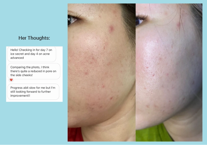 Pore Minimising & Brightening Serum Kit