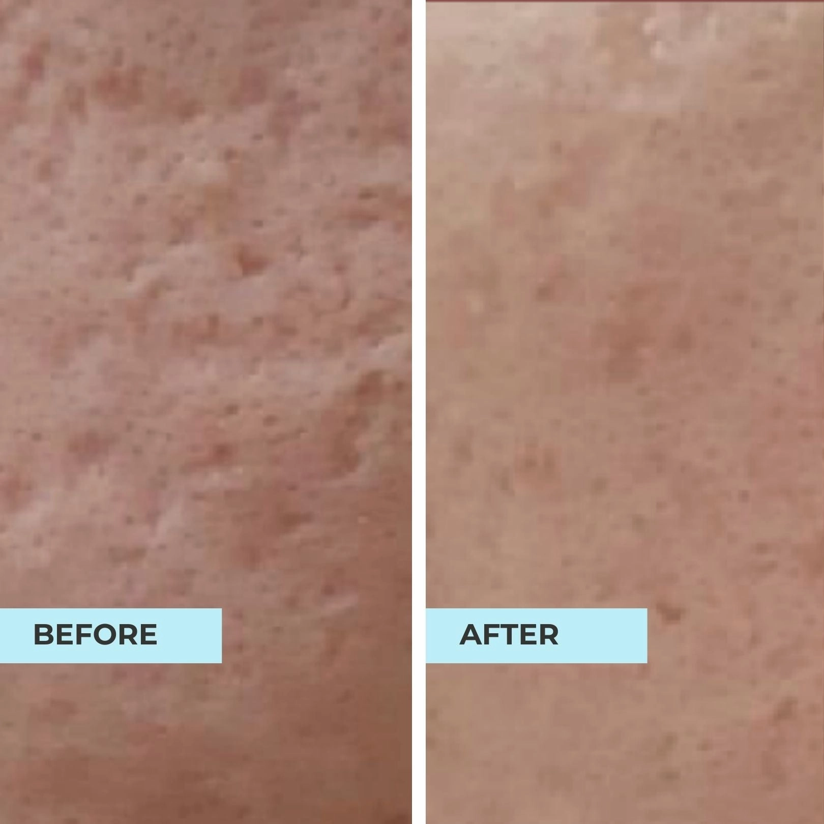Pore Minimising & Brightening Serum Kit
