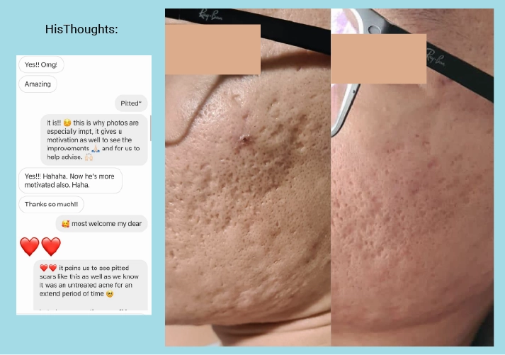 Pore Minimising & Brightening Serum Kit