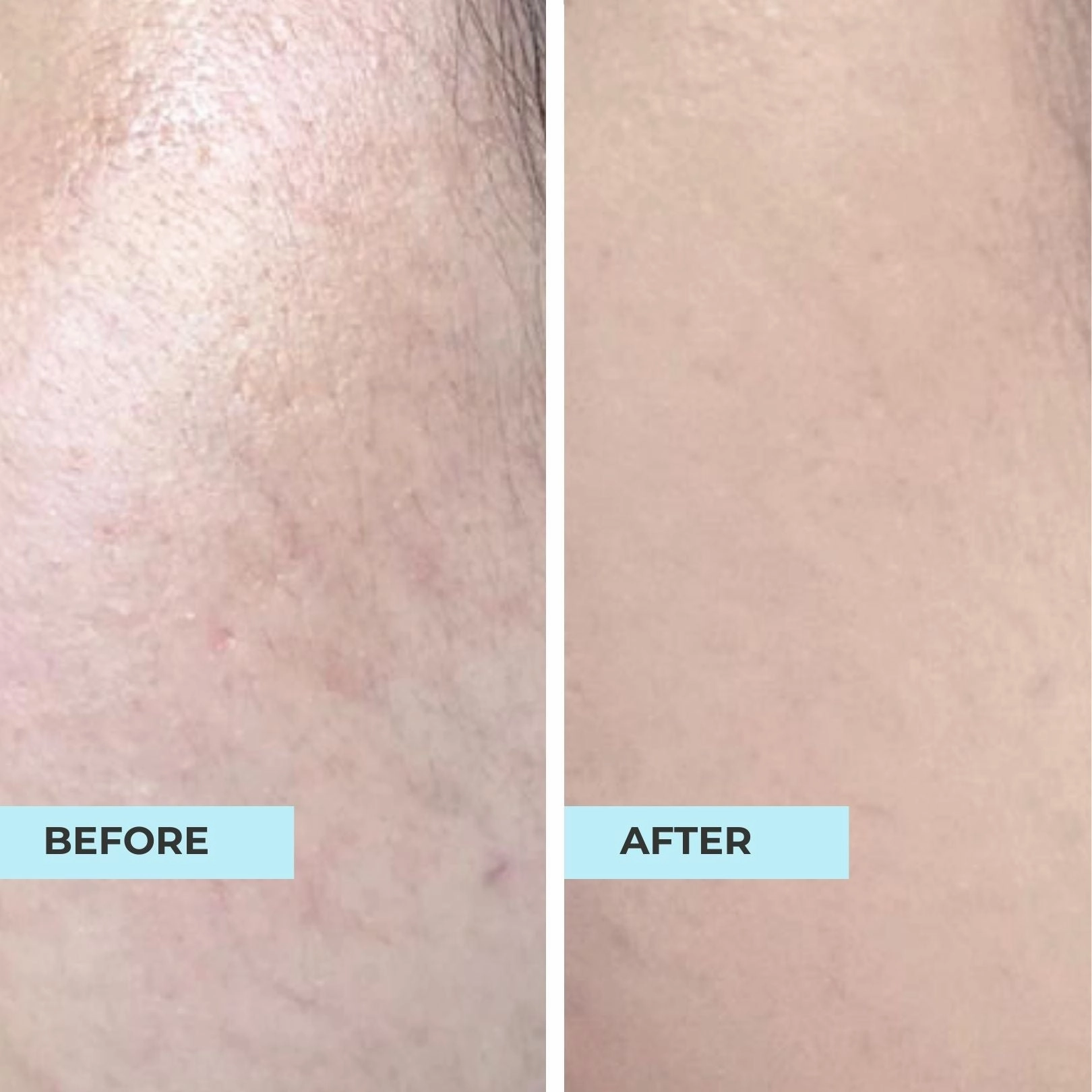 Pore Minimising & Brightening Serum Kit