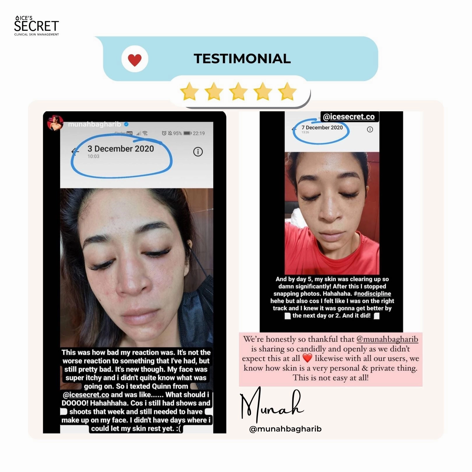 Pore Minimising & Brightening Serum Kit
