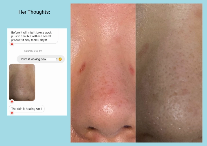 Pore Minimising & Brightening Serum Kit