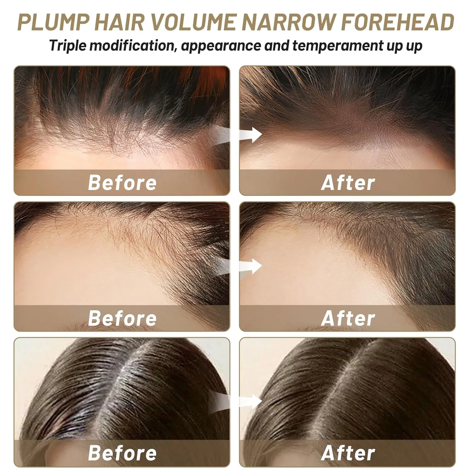 Root Touch Up Hairline Powder 0.42oz Instantly Conceals Hair Loss for Thinning Hairline Cover Up Hairline Shadow Filler for Women & Men (Light Brown)